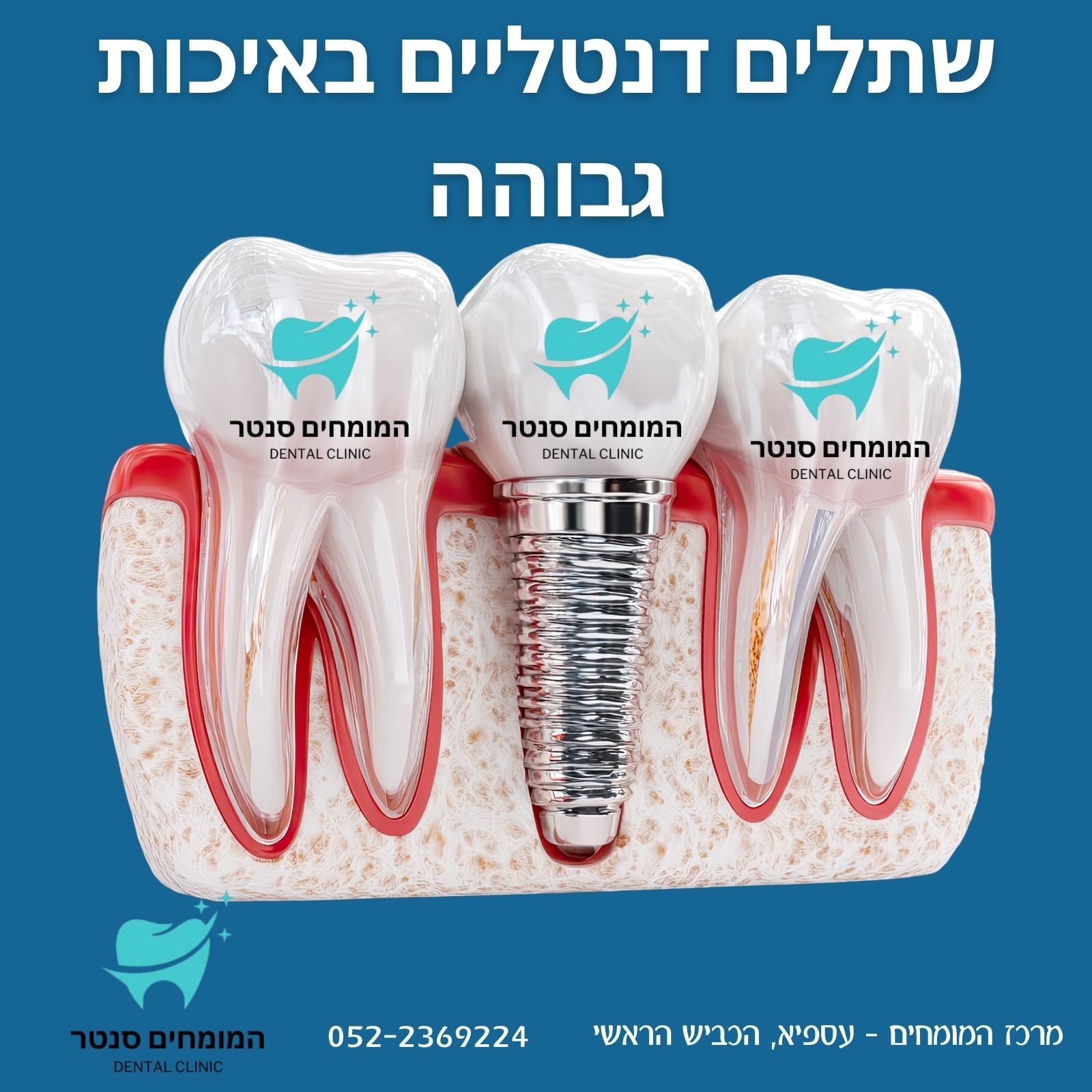 השפעות חוסר שיניים